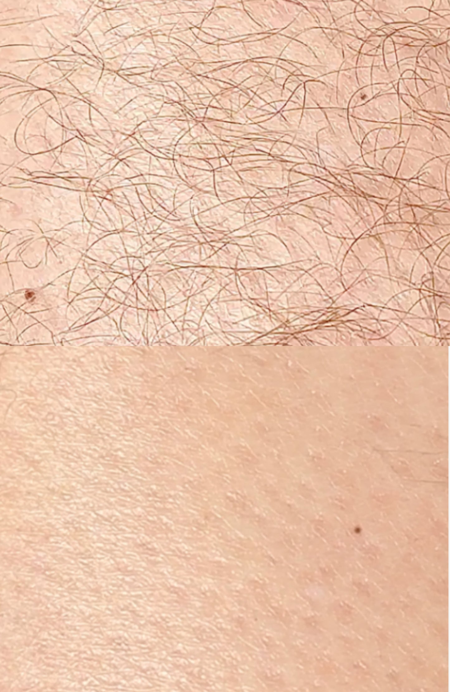ANSWR Exfoliating Hair Removal Drop