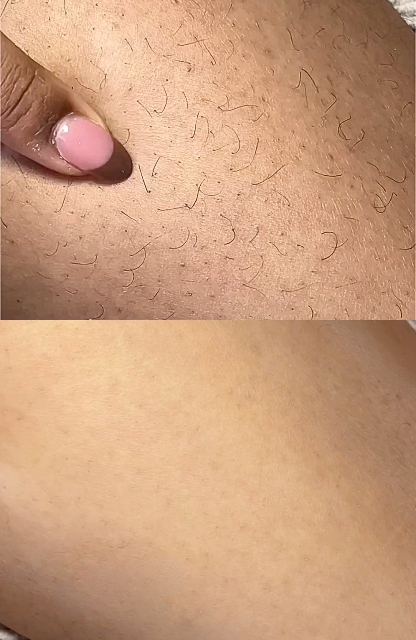 ANSWR Exfoliating Hair Removal Drop