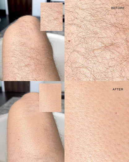 ANSWR Exfoliating Hair Removal Drop
